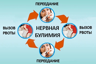 Лечение булимии в Улетах